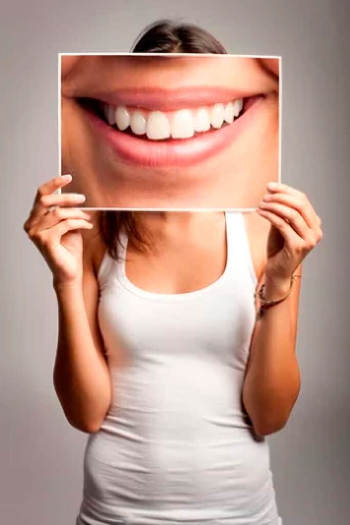 por que carillas dentales