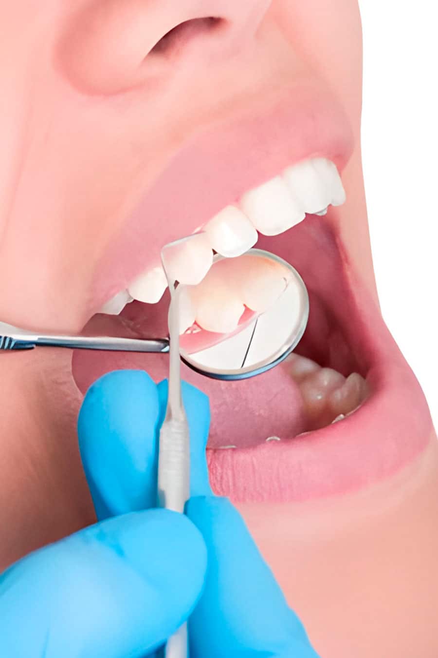 clinica dental bruxismo en donostia