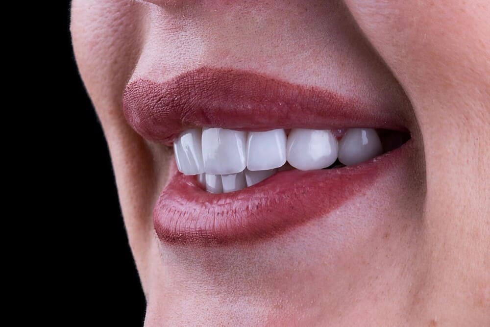 mujer con maloclusion dental