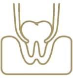 extracción dental