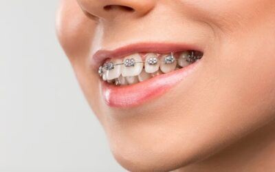 Precio de la ortodoncia