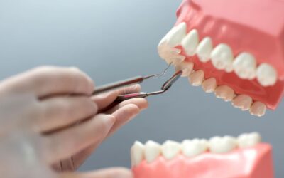 Precio de las prótesis dentales