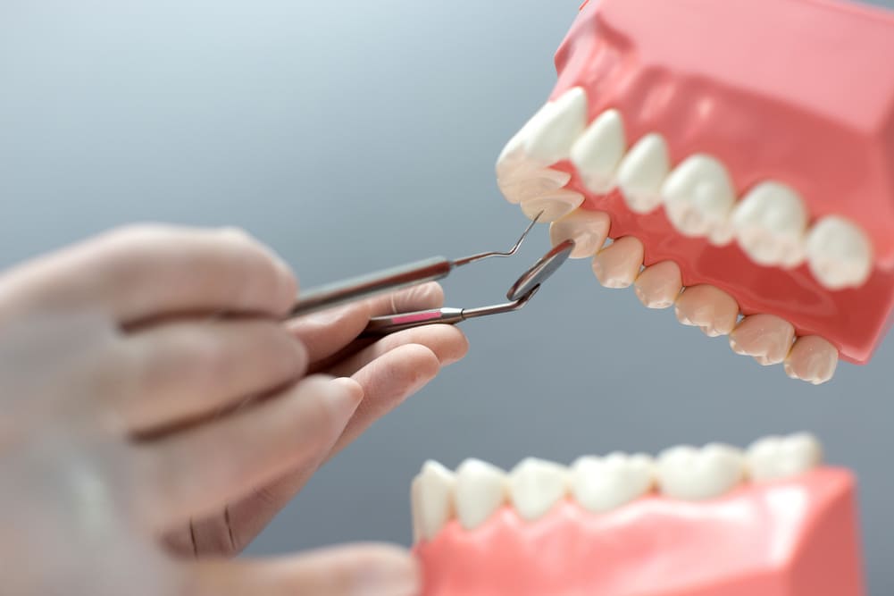 Precio de las prótesis dentales