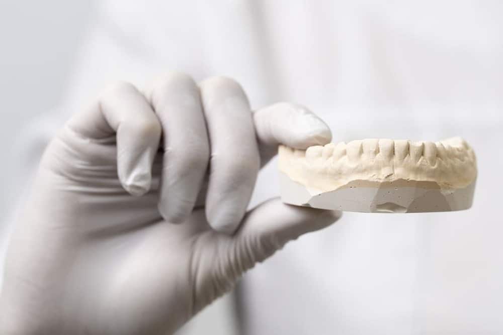 dentista con modelo de prótesis dental