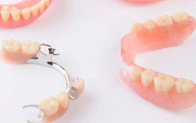 Prótesis dentales removibles en Donostia