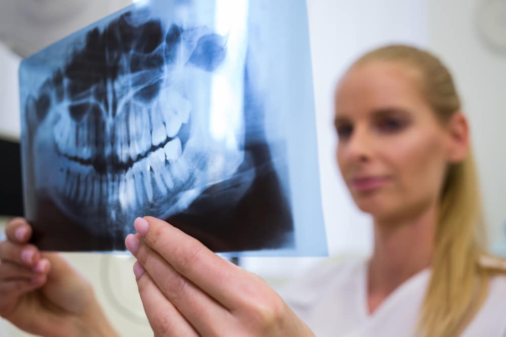 dentista mirando placa rayos-x
