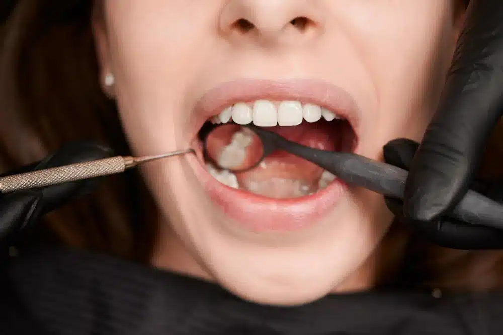 dentista observando checkeando boca paciente