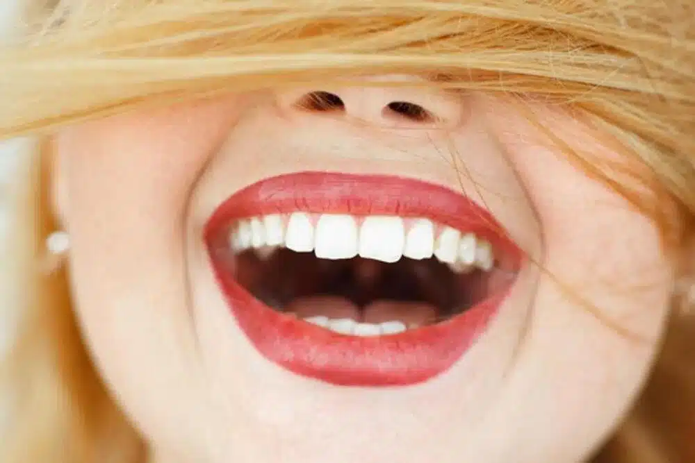 Antiaging dental 360: ¿Qué es?