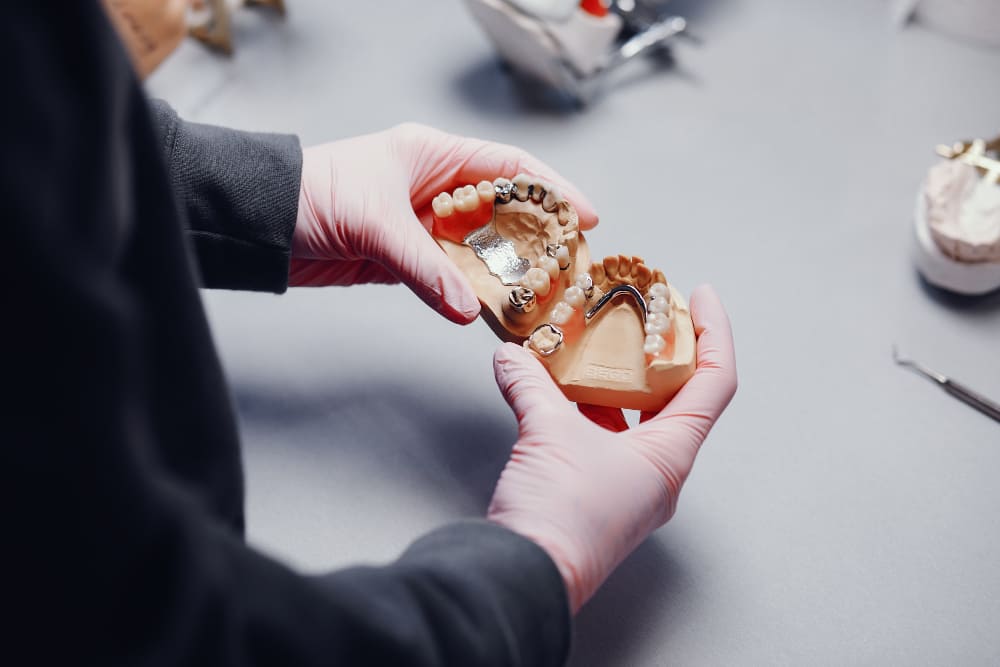 modelo de dentadura en manos con fondo difuso y mesa de trabajo