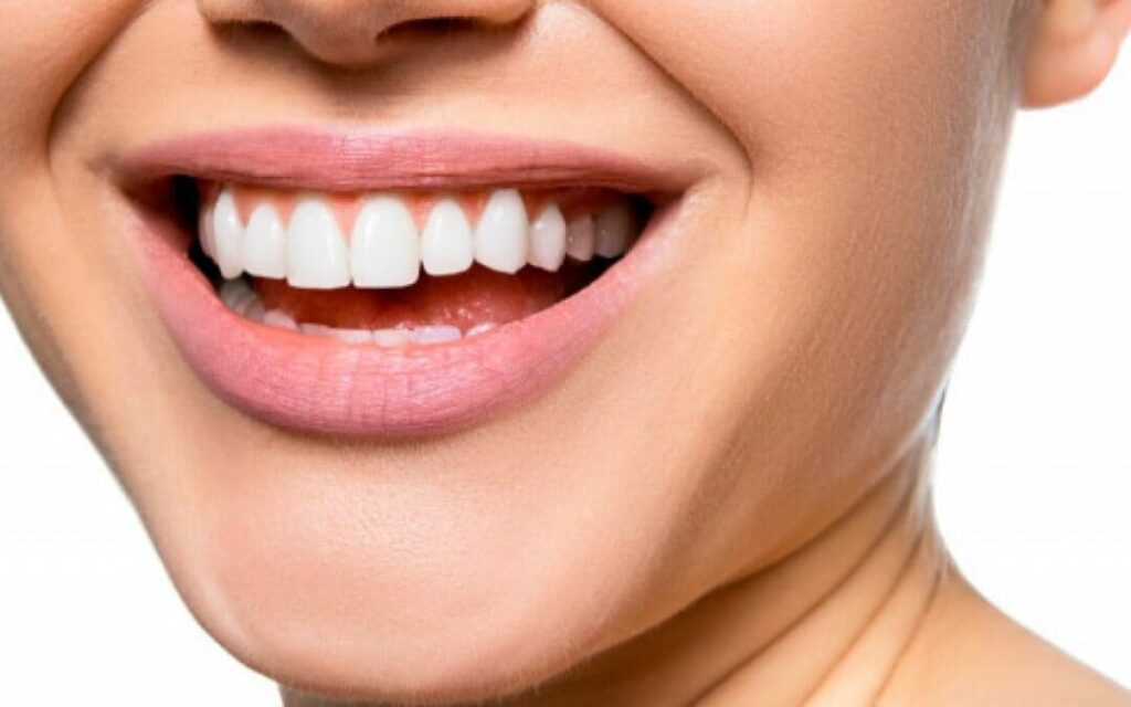 dientes blancos coronas dentales sonrisa mujer clinica