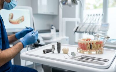 Implantes dentales: riesgos y qué debes saber