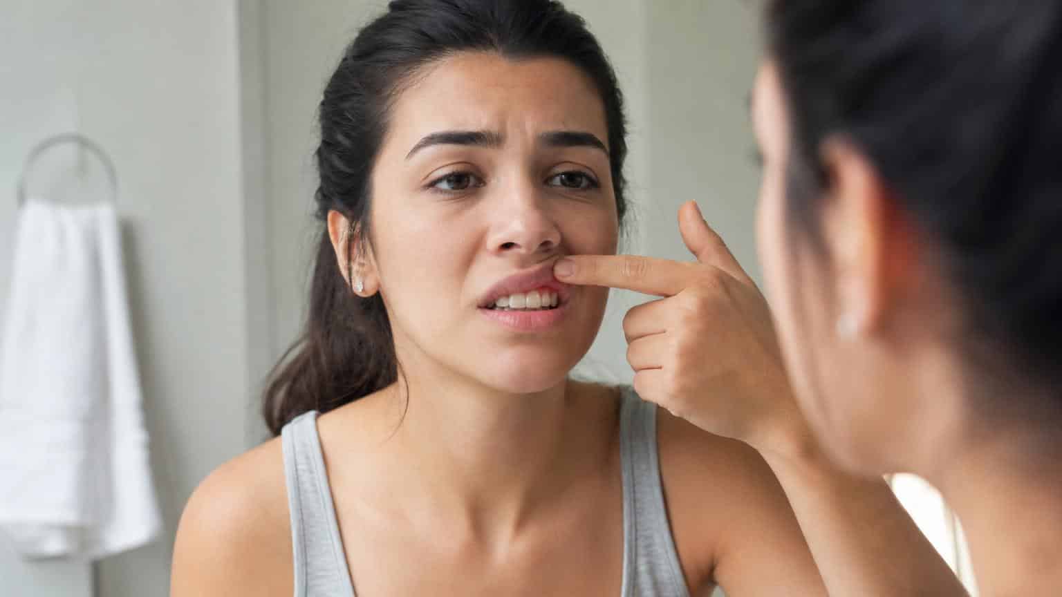 Woman looking in a bathroom mirror while lifting her upper lip to examine red, inflamed gums. Woman looking in a bathroom mirror while lifting her upper lip to examine red, inflamed gums.