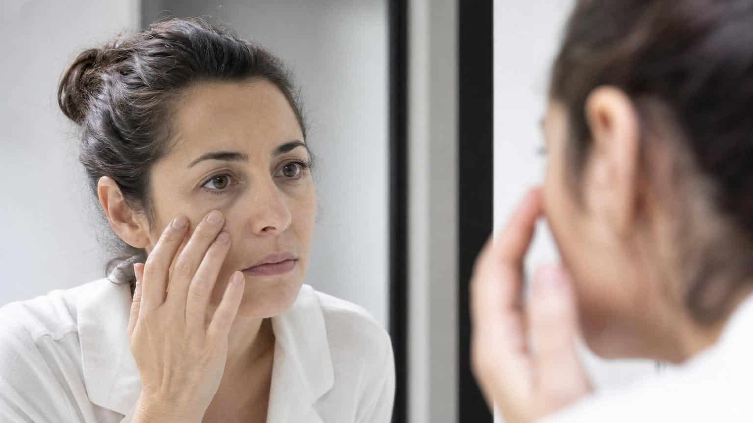 Woman looking in a bathroom mirror while touching the deep bags and dark circles under her eyes.