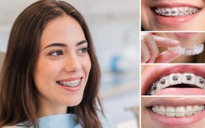 Tipos de ortodoncia dental: guía completa