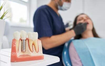 Mejores marcas de implantes dentales